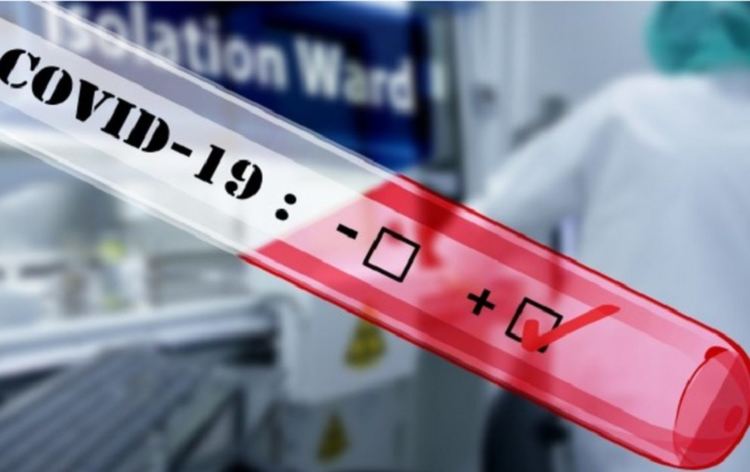 Нови два случая с потвърдени проби на covid-19 в Смолян