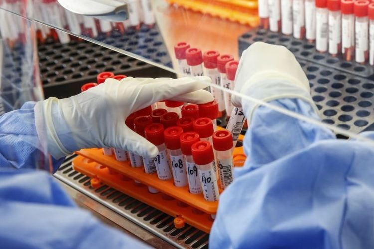 Първа ли е България в света по смъртност от COVID-19?