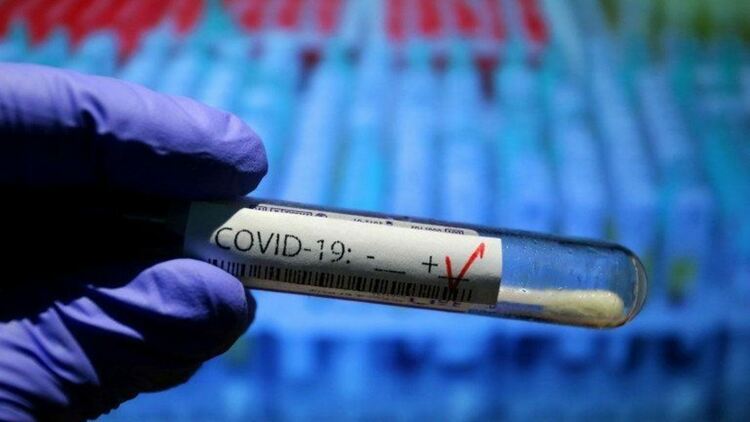 17 са починалите с COVID-19 в област Пловдив за изминалото денонощие 
