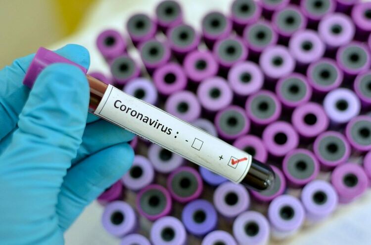 362 са новите случаи на COVID-19 в област Пловдив за изминалите почивни дни