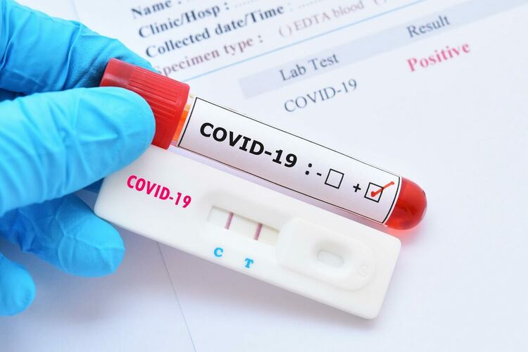 Още области в жълтата зона по ниво на заболеваемост от COVID-19