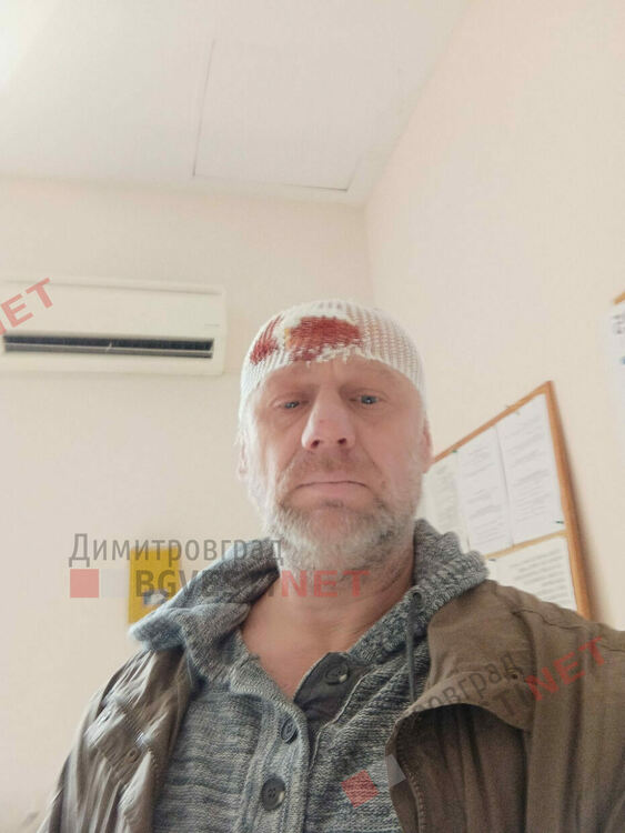Д-р. Йотов: Опитаха да ме убият в центъра на Димитровград с метална тръба, тук не е сигурно. Мъж почина след инцидента.
